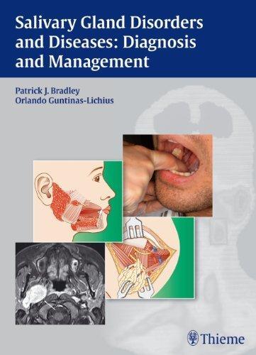 Salivary Gland Disorders and Diseases: Diagnosis and Management