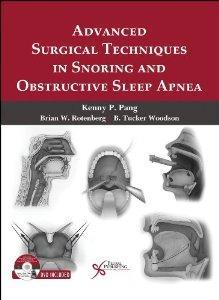 Advanced Surgical Techniques in Snoring and Obstructive Sleep Apnea