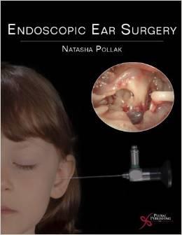 Endoscopic Ear Surgery