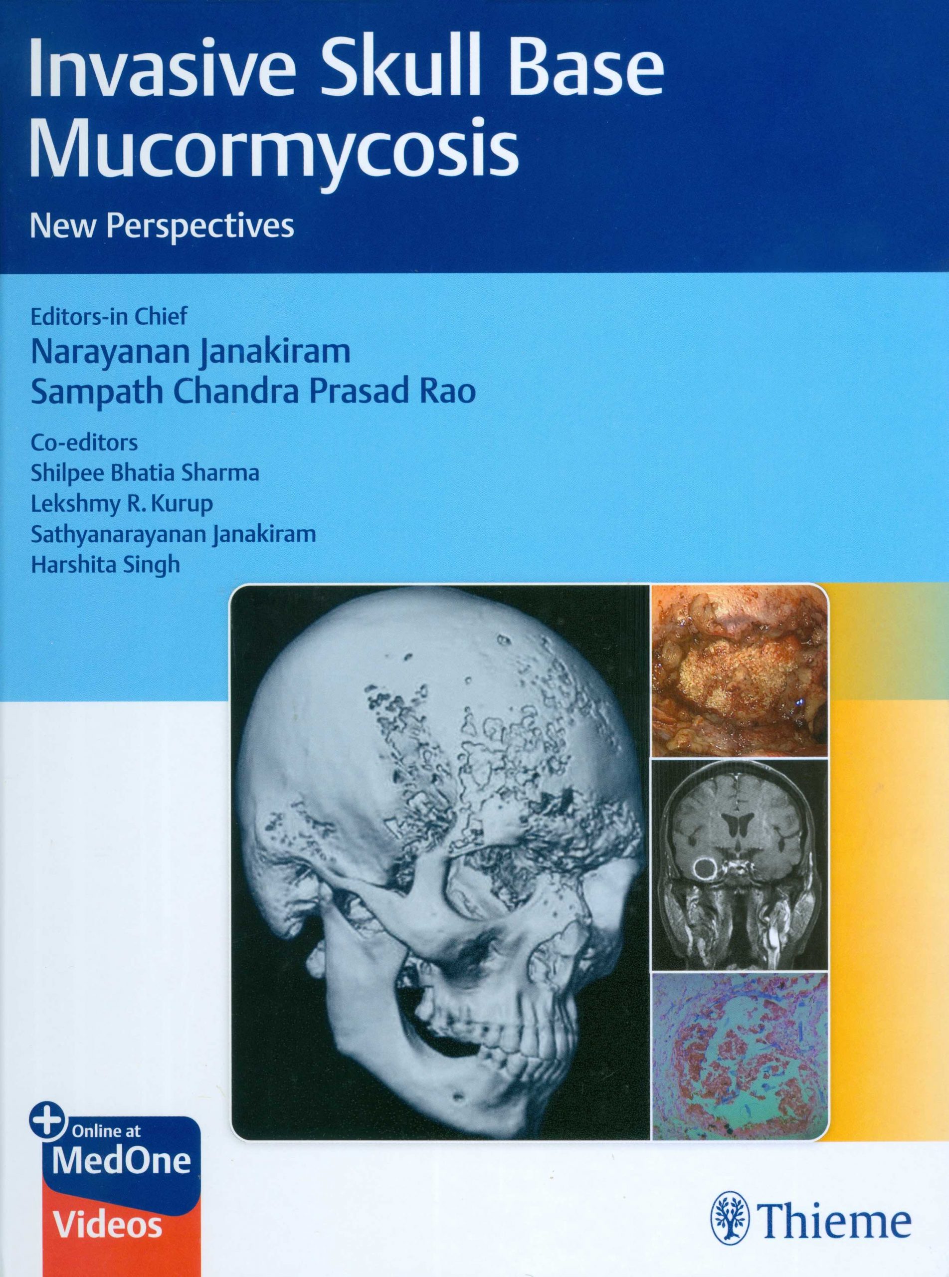 Invasive Skull Base Mucormycosis: New Perspectives